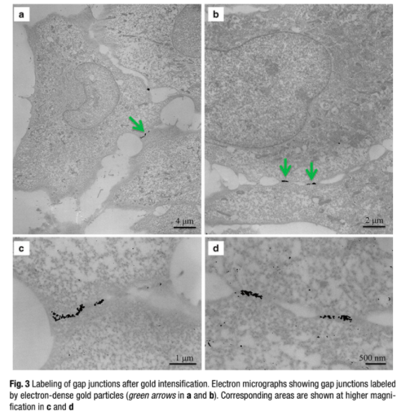 Correlative light and electron microscopic observation of calcium