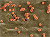 hiv_infected_cells 2